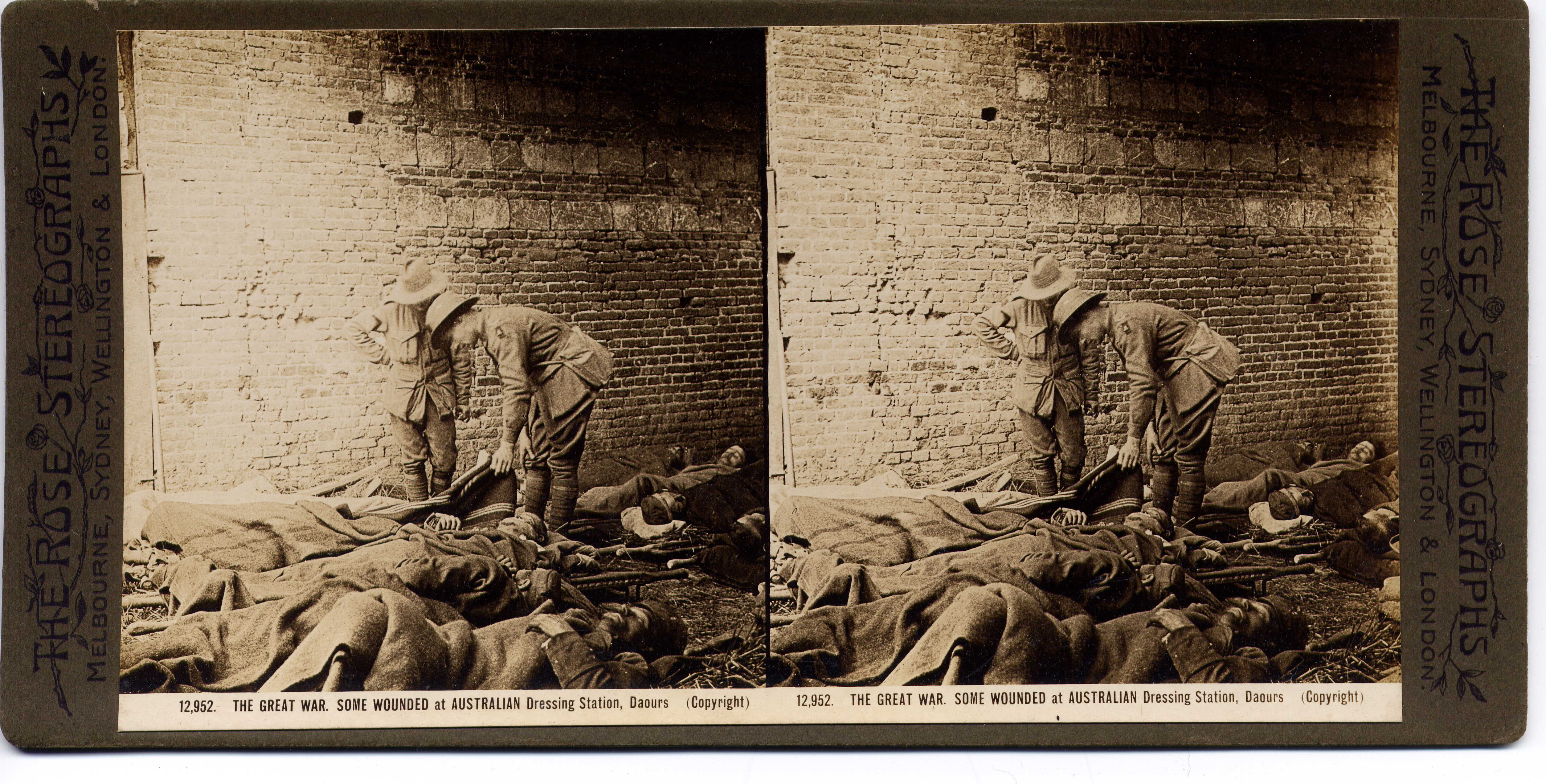 THE GREAT WAR. SOME WOUNDED at AUSTRALIAN Dressing Station, Daours.