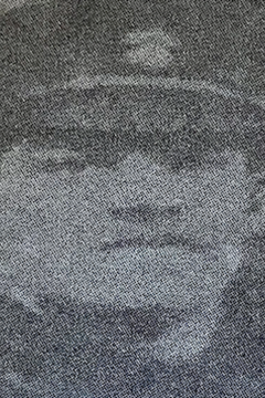 25 November 1916 : Pte Thomas Dawson