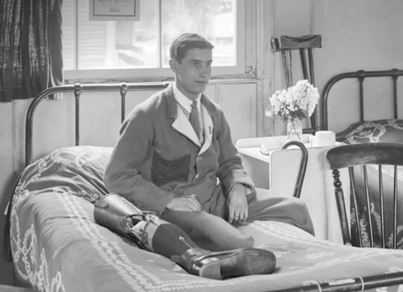 Amputee with his prosthetic leg, Queen Mary’s Hospital, Roehampton, London.  © Historic England Bedford Lemere Archive BL24278.