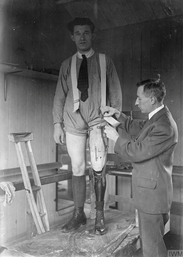 Roehampton. Fitting a limb before final completion. © IWM Q 33679