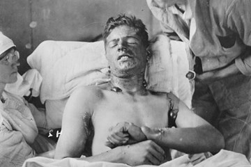 The Rationale for and the Deployment of Poisonous Gas on The Western Front in the Great War