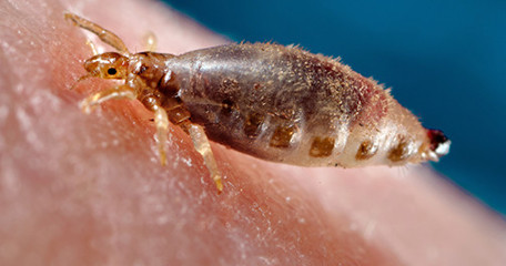 Pediculus Humanis Corporis
