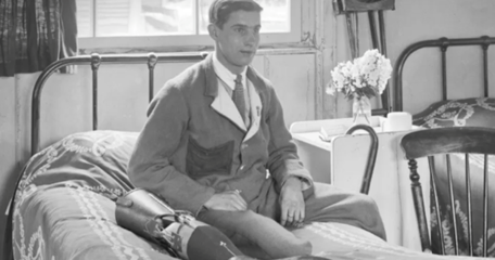 Amputee With His Prosthetic Leg